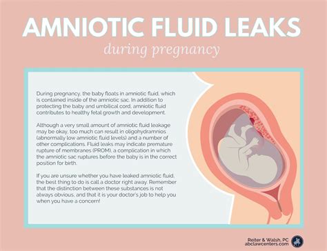 leakage of amniotic fluid|Leaking Amniotic Fluid: Signs, Causes, and。